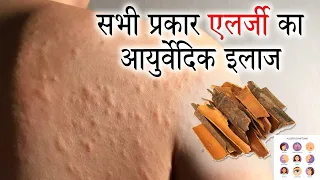 गर्म पानी में दालचीनी पीने के 23 फायदे | Allergy ki dawai | दालचीनी के फायदे और नुकसान