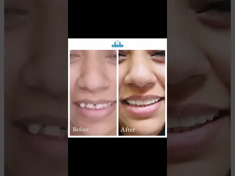 Smile design video testimonial