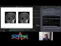 Image Compression using Wavelet Transform
