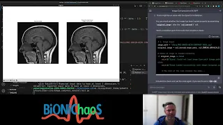 Image Compression using Wavelet Transform