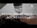 Radio Frequency - Microneedle Cocoon Medical Spa