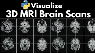Neuroimaging Visualize 3D MRI Brain Scans with Python