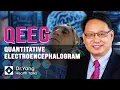 Unleashing the Power of Your Brain with QEEG QEEG brain scans explained Brain Mapping Therapy