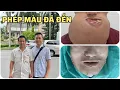 Download Lagu Sau 24 giờ phẫu thuật, điều gì đang diễn ra với em Dìa...?