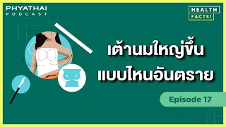 หากคลำพบก้อนในเต้านมควรทำอย่างไร และก้อนใดที่ต้องกังวลมากที่สุด