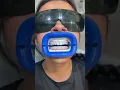 Watch the process of our in-office teeth whitening treatment