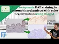How to separate DAB staining in a IHC with color Deconvolution using ImageJ