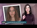 Download Lagu A Transformação No Rosto de Anitta (Domingo Espetacular) [HD]