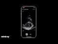 Mindray Te Air Tutorial Basic Measurement