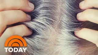 Do anti-gray hair products really work