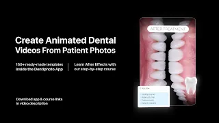 Dental Motion Design - Dentiphoto