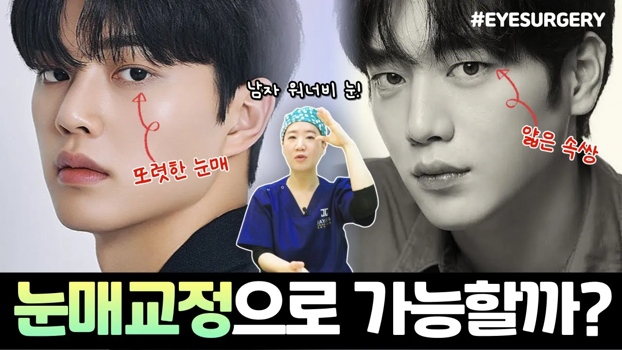 눈이 커지고 싶은데 느끼해지는건 싫다면 이 영상을 보세요! | 남자 눈매교정 제이준성형외과