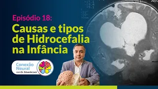 CAUSAS E TIPOS DE HIDROCEFALIA NA INFÂNCIA | EP. 18