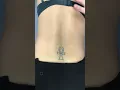 Pinch roll test