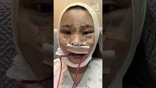 Plastic Surgery Transformation In Korea Idhospital Shorts 
