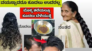 ಉದರಿದ ಕೂದಲು ಬೆಳೆಯಲು ಯಾರು ಹೇಳಿರದ ಸೀಕ್ರೆಟ್ ಪದಾರ್ಥ ಕೂದಲು ಡಬಲ್ ಆಗಿ ಬೆಳೆಯುತ್ತೆ 