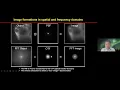 Liangyi Chen - Overcoming physical resolution limits with sparse deconvolution