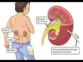 Cholecystography CPT code - simplify medical coding