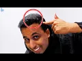 How I Fixed the Headphone Dent in My Head Gamer Dent