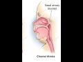 Repair choanal atresia CPT code - simplify medical coding