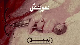                 ويجز   سويتش دندنها