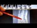 Wellstar Spine Care