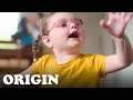 This 2 Year Old Girl Has One Of The World s Rarest Genetic Disorders