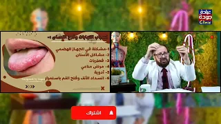 التهابات وقرح اللسان والفم دكتور جودة محمد عواد دكتور جودة محمد عواد 