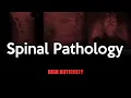 Spinal Pathology X-ray Quiz High Difficulty