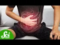 Download Lagu Why More Young People Are Getting Colon Cancer