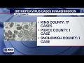 DOH 20 people in Washington likely have monkeypox