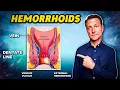 The Best Remedy for Hemorrhoids - Dr Berg