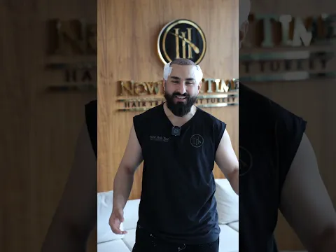 Siz bir nömrəsiz @NowHairTime #sacekimi #2026 #youtubeshorts #azerbaijan #istanbul #hair