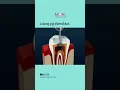 Lagu Ilustrasi Perawatan Saluran Akar Gigi