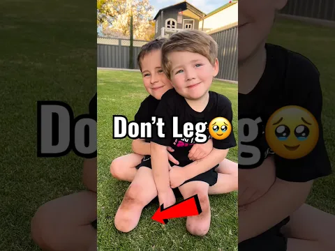 This Cute Boy doesn’t have 1 Leg 🦵💔🥺 |