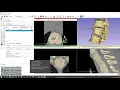 CT or MRI to 3D print DICOM to STL with Local computer Part 1 of 2