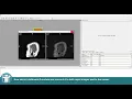 MeVisLab Tutorials - Image Processing