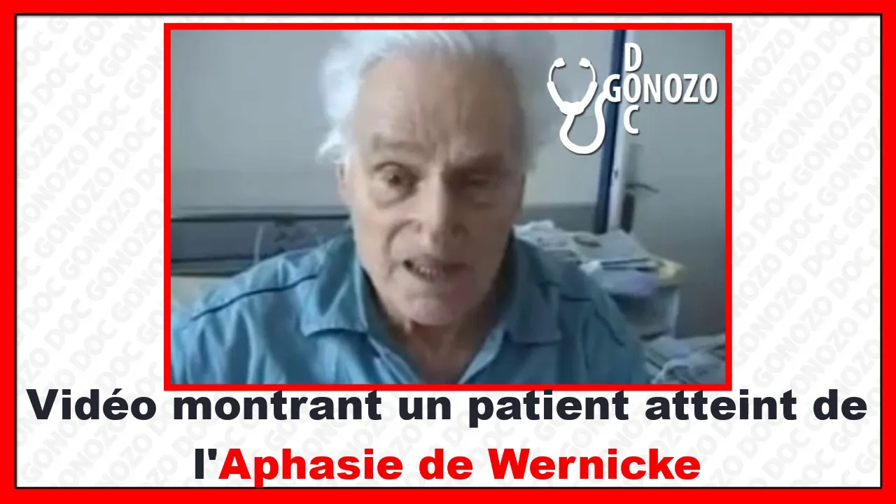 comparaison entre l'aphasie de BROCA et l'aphasie de WERNICKE