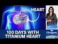 Download Lagu World's First: Man Lives 100 Days with Artificial Titanium Heart | Vantage with Palki Sharma | N18G