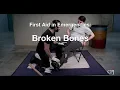 10a Treating Broken Bones