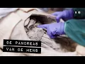 Lagu De pancreas van de mens | Aflevering 4 | De Binnendienst