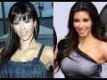 Kim Kardashian Plastic Surgery Before and After Photos