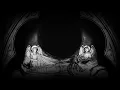 2 Hours Occult Dark Ambient Ritual | INCUBATIO - Sleep and Visions in Darkness