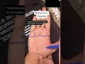 Monkey s line or Simian line Palmar Crease also found in Down s Syndrome