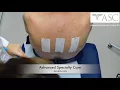 Patch Testing at Advanced Specialty Care