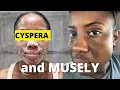 My Skincare Routine using Cyspera Cysteamine and The Musely Spot Cream