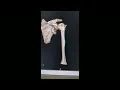 Ayyappan V Nair | Reverse Shoulder Replacement