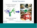 In silico design of novel surgical methods for children with single ventricle hearts