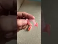 FLEXIBLE VS ORDINARY DENTURE pustiso
