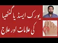 Download Lagu Uric Acid Symptoms and Treatment in Urdu | Causes and Treatment of high Uric Acid or Gout at home